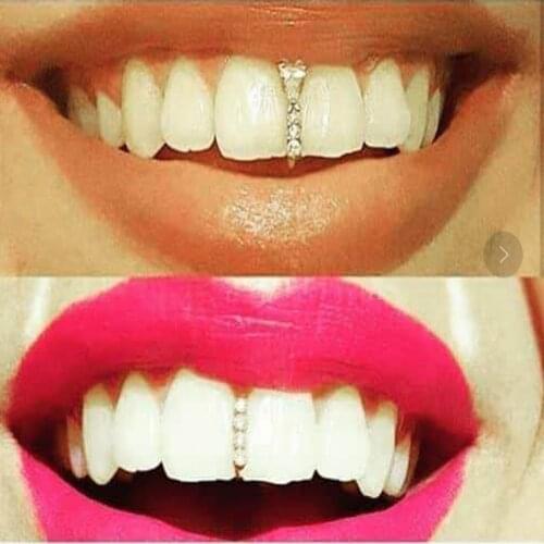 1 Pc Gold Silvertone Color Tooth Cap Crystal Stick Shape Top Teeth Case Rock Hip Hop Cover Grills Braces Teeth Decor KL30FI5