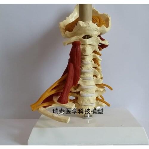 Cervical spine Carotid artery Intervertebral disc and neural teaching model