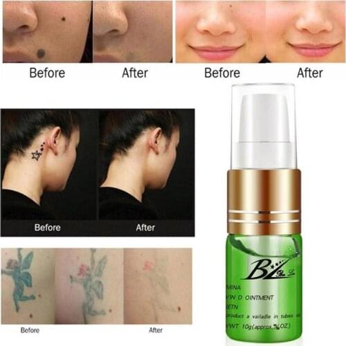1 Pcs Tattoo Recovery Aftercare Serum Skin Tag Removal Ointment Top Eyebrow Tattoo Repairing Cream Tattoo Ice Essence Products