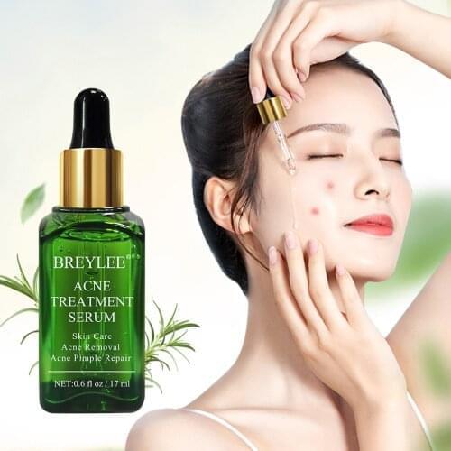 BREYLEE 17ml Acne Treatment Face Serum Mask Anti Acne Pimple Scar Remover Moisturizing Whitening Skin Care Facial Essence Cream