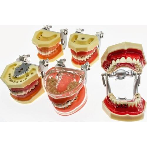 Dental Teaching Teeth Model Simulation Model Adult Pathological Periodontal disease for Oral Simulation Teeth model