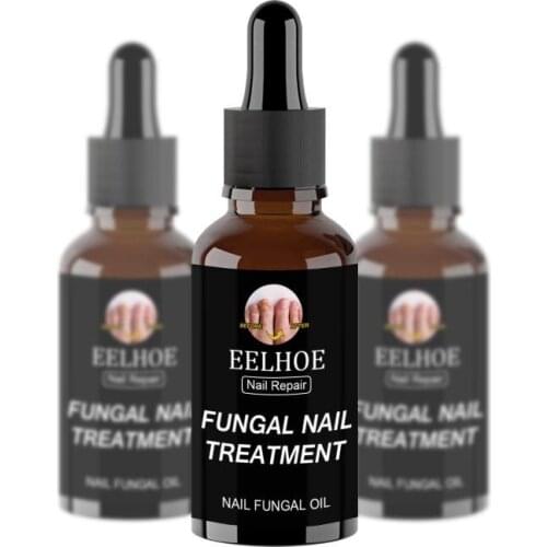 Fungal Nail Repair Serum Care Foot Nail Fungus Removal Gel Anti Paronychia Onychomycosis Repair Liquid Nail Care Treatments