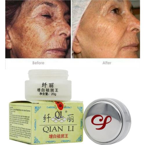 Qian Li Powerful Whitening Freckle Cream 20g Fast Remove Speckle Melasma Pigment Melanin Acne Spots Face Care Cream