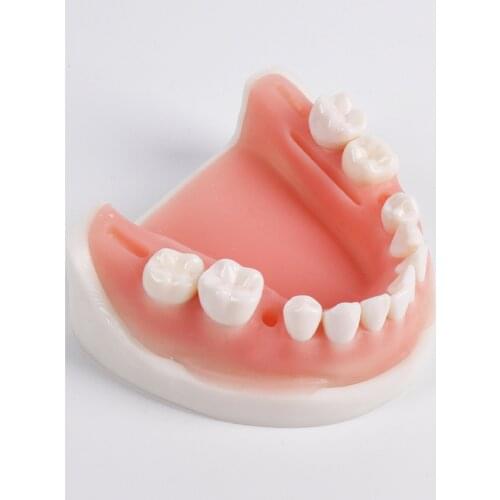 Simulation oral suture model with tooth preparation suture medical teaching training tool skills periodontal suture practice