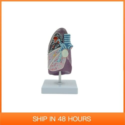 Diseased Human Lung Structure Respiratory System Model for Anatomical Study Display Teach Anatomy Medical Supply and Equipment