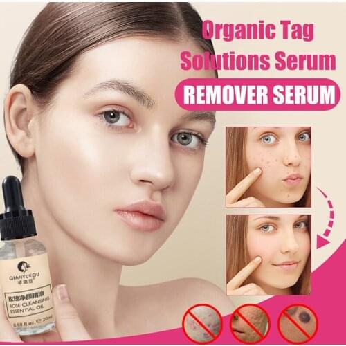 Mole & Skin Tag Removal Solution Mighty Tag Spots Remover Serum Painless Mole Skin Dark Spot Removal Freckle Removal Cream