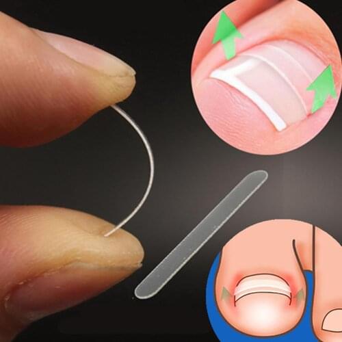 10Pcs/Box Ingrown Toe Nail Correction Sticker Paronychia Foot Care Treatment