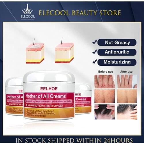 20g/30/50g Skin Psoriasis Cream Dermatitis Eczematoid Ointment Skin Rash Urticaria Desquamation Skin Care Cream Cosmetics TSLM1