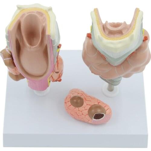 Thyroid Diseased Model Thyroid Gland Anatomical Human Anatomy Medical Teaching Educational Equipment Pathologic Model