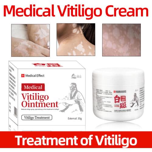 30g Vitiligo Treatment Cream Chinese Medical Pigment Melanin Promoting Liniment Skin White Spot Leukoplakia Disease Treatment