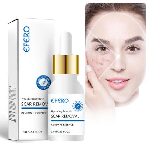 Efero Scar Remove Essence Acne Treatment Blackhead Anti Acne Oil Control Shrink Pores Whitening Moisturizing Face Care Essence