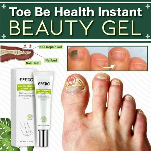 Nail Fungus Removal Gel Onychomycosis Fungal Nail Treatment Cream Paronychia Anti Infection Feet Toe Fungal Nail Care Ointment