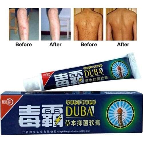 10pcs DUBA Body Psoriasis Cream For Dermatitis And Eczema Pruritus Psoriasis Ointment Herbal Creams Skin Care Psoriasis Cream