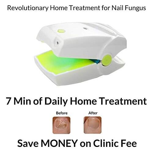 Highly Effective Rechargeable Nail Fungus Laser Treatment Device Nail Infection Onychomycosis Cure Nail Fungal Infections