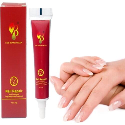 Herbal Nail Treatment Onychomycosis Paronychia Anti Fungal Nail Infection Good Result Chinese Herbal Toe Nail Fungus Treatment