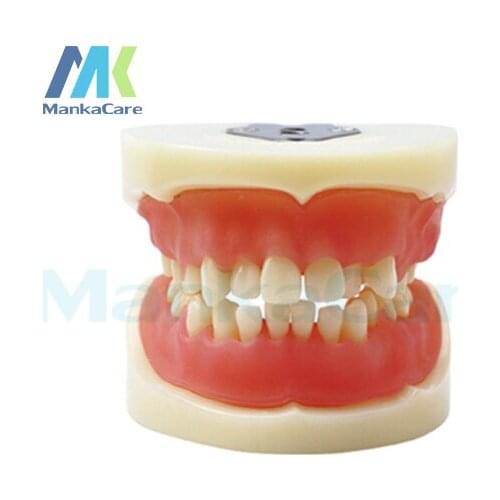 Manka Care - Physician certification model Oral Model Teeth Tooth Model