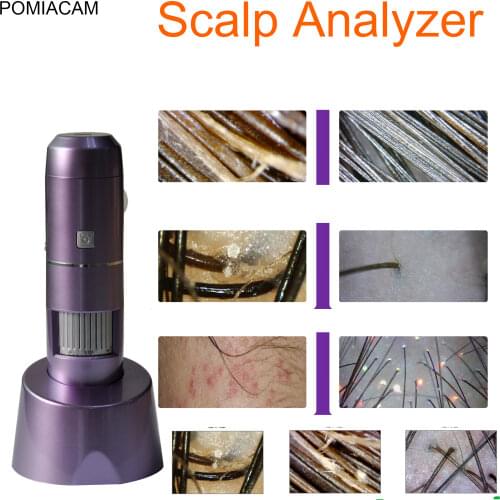 WIFI 5X-200X Intelligent Dermal Detector Smart Skin Analyzer Hair Analysis Detection Beauty Digital Scalp Hair Microscope