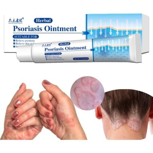 Herbal Psoriasis Cream Treatment Eczema Dermatitis Remove Foot Psoriasis Antipruritic Antibacterial Herbal Ointment Skin Care 1p