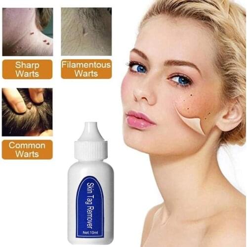 10/20/30ML Wart Removal Beauty Liquid Skin Tags Removing Against Moles Remover Anti Verruca Remedy