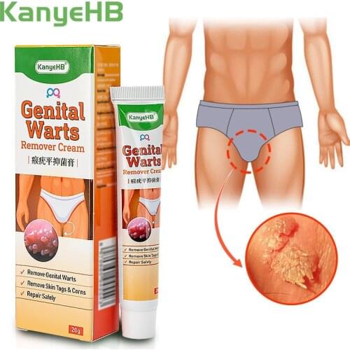 1PC Genital Herpes Wart Remover Ointment Skin Tag Mole & Papillomas Wart Remover Condyloma Acuminatum Treatment Cream