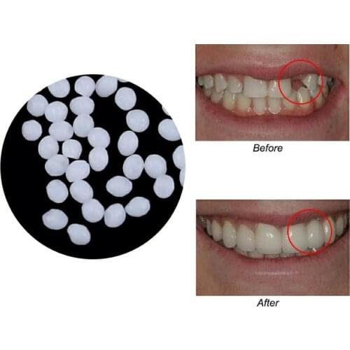 Teeth Repair Kit Thermal Molding Dental Material Beads Temporary Fake Teeth Replacement Tooth Filling 2021 New Products