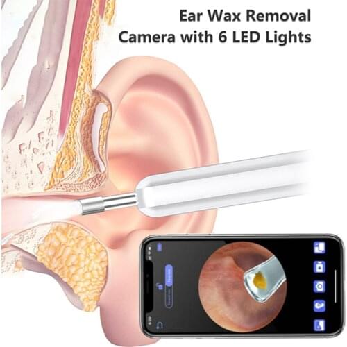 Приборы для чистки ушей Zoechic China At AliExpress