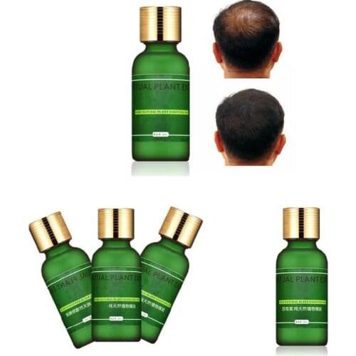 Breathleshades Hair Loss Remedies