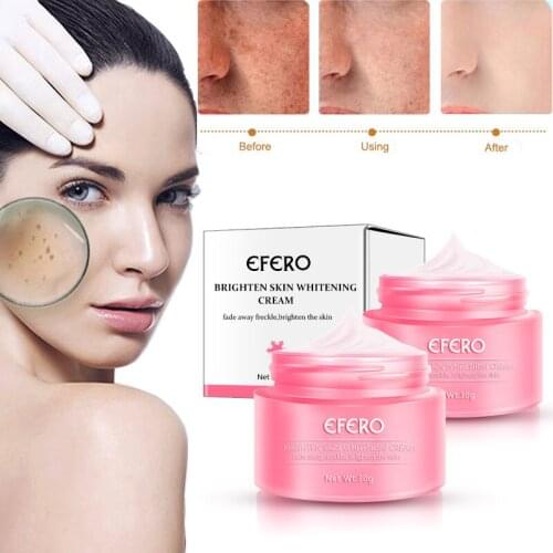Face Cream Whitening Freckles Remove Anti Age Black Spots Skin Care Dark Spots Lightening Smooth Face Serum whitening cream