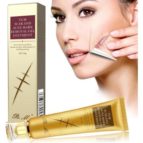 30g Acne Scar Removal Cream Pimples Stretch Marks Face Gel Remove Acne Smoothing Whitening Moisturizing Body Skin Care