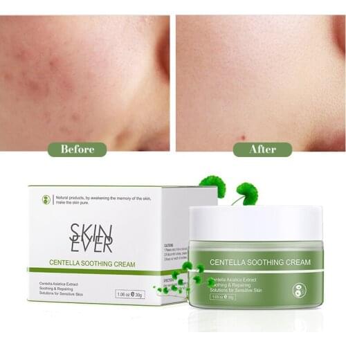 Centella Asiatica Repairing Cream Moisturizing nourishing anti-inflammatory soothing sensitive and repairing facial care
