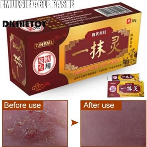 Effective Foot Cream Chinese medicine paste Relieve Itching Moisturizing Skin Cleaning Care Beriberi Treatment Cream FB