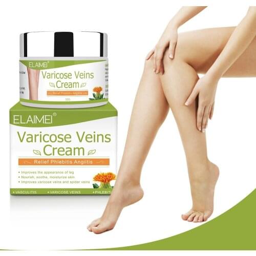 Varicose Veins Treatment Cream Effective cure Vasculitis Phlebitis Spider Veins Pain Varicosity Angiitis ointment Health Care