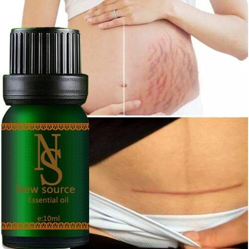 100% Natural Ultra Brightening Essential Oil Scar Removal Moisturizing Spotless Skin Brightening Oil for Skin Care 10ml