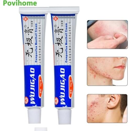 2pcs Antipruritic Crean Mosquito Bite Repellents Anti-Itching Ointment Anti-inflammation Eczema Psoriasis Herbal Cream D3195