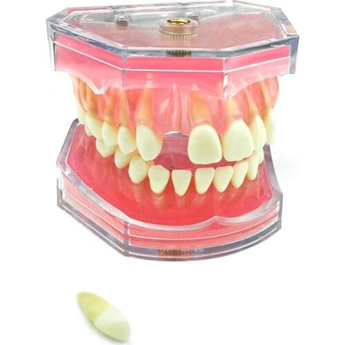 Removable Teeth Soft Gum ADULT TYPODONT Model Dental Education Model