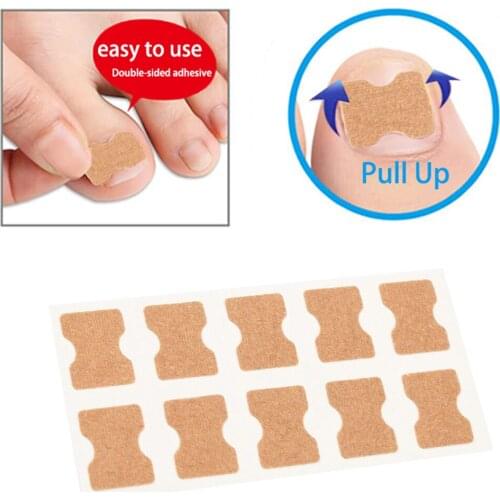 Ingrown Toenail Correction Patch Inlay Toenail Patch Painless Corrector Paronychia Fixer Recover Nail Patch Correction