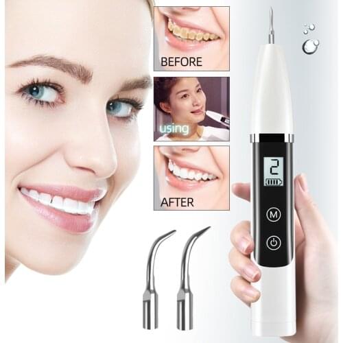 Oral Irrigators Kyliebeauty China