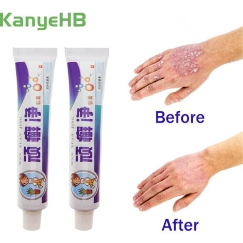 1pcs Psoriasis Creams Chinese Herbal Pain Relief Eczema Ointment Pruritus Dermatitis Itching Medical Plaster Skin Care S016