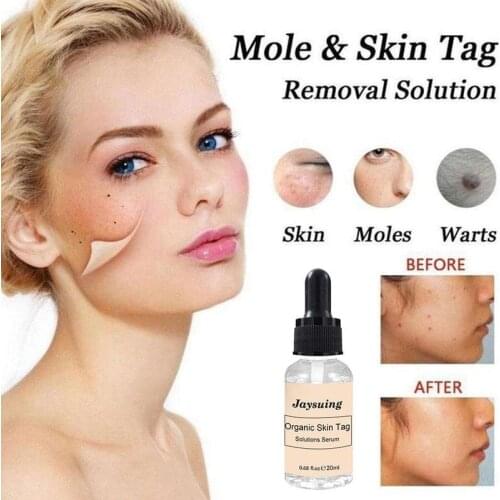 Organic Skin Spot Purifying Serum Natural Free Face Mole Tag Label Removal Freckle Care Repair Cream Painless Odorless