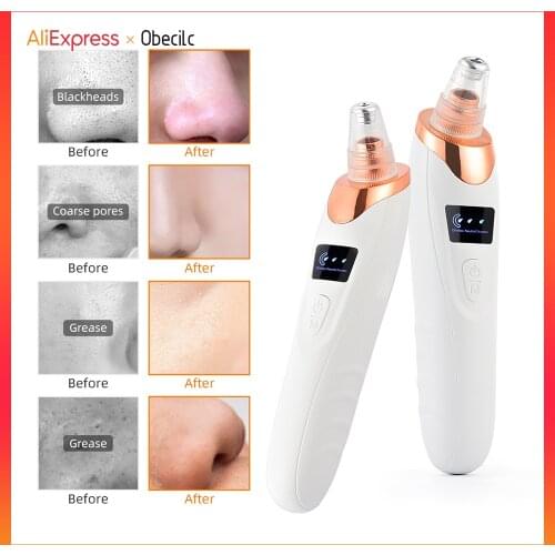 USB Rechargeable Blackhead Remover Vacuum Suction Face Pimple Comedone Acne Cleaner Facial Deep Cleannig Machine Skin Care Tool
