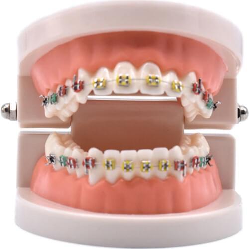 Dental Orthodontic Treatment Model With Ortho Metal Ceramic Bracket Arch Wire Buccal Tube Ligature Ties Dental Tools Dentist Lab