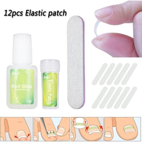 10PCS/Bottle Ingrown Toenail Correction Tool Set Ingrown Toe Nail Pedicure Elastic Patch Straightening Clip Brace with Glue