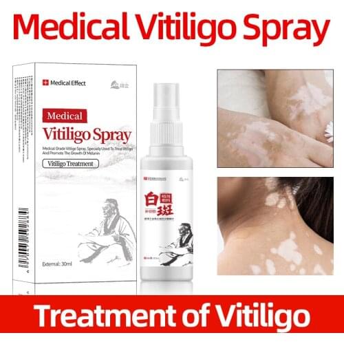 Chinese Medical Vitiligo Antibacterial Spray Leukoplakia Disease Repair Liquid Promoting Pigment Melanin Treatment