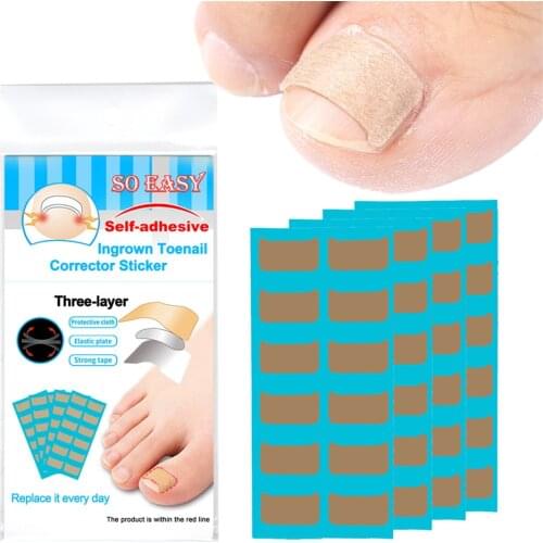 36pcs Nail Art Ingrown Correction Sticker Foot Care Pedicure Tool Fixer Paronychia Recover Toenail Elastic Patch Corrector
