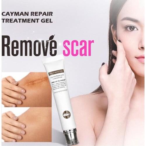Repair Scar Cream Healing Gel Vibrant Glamour Crocodile Cream Remove Marks Pregnancy Stretch Liquid Bump Scalded T5N8