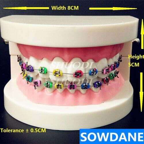 Dental Orthodontic Treatment Model With Ortho Metal Bracket Arch Wire Buccal Tube Ligature Ties teeth model Tooth model