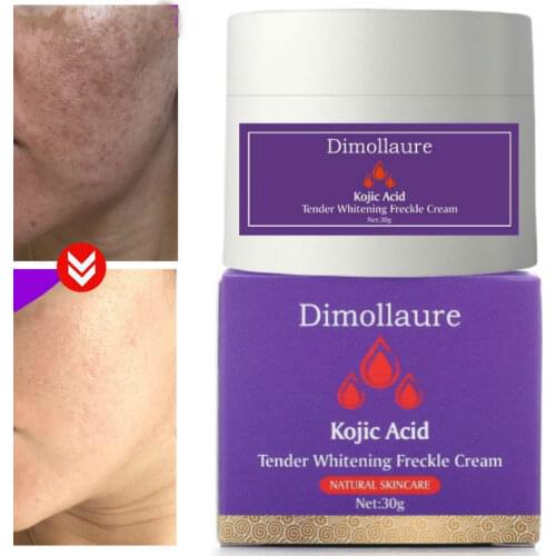 Dimollaure Kojic Acid whitening cream 30g Retinol Wrinkle removal Freckle melasma Acne scar pigment age spot melanin Vitamin C