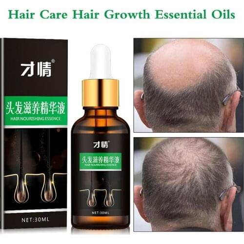 Hair Care Hair Growth Essential Oils Essence Original Authentic 100% Hair Loss Liquid Health Care Beauty Dense Hair Growth Serum