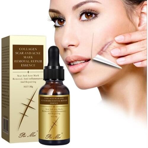 30g Lavender Essence Scar Repair Skin Essential Oil Natural Pure Remove Ance Burn Strentch Marks Scar Removal