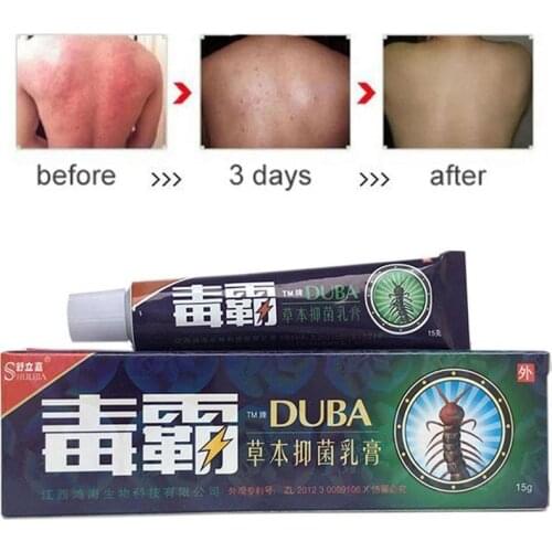 Herbal Cream Anti-itch Cream Centipede Antibacterial Ointment Psoriasis Cream Pruritus Dermatitis Jock Itch Mosquito Bites Skin